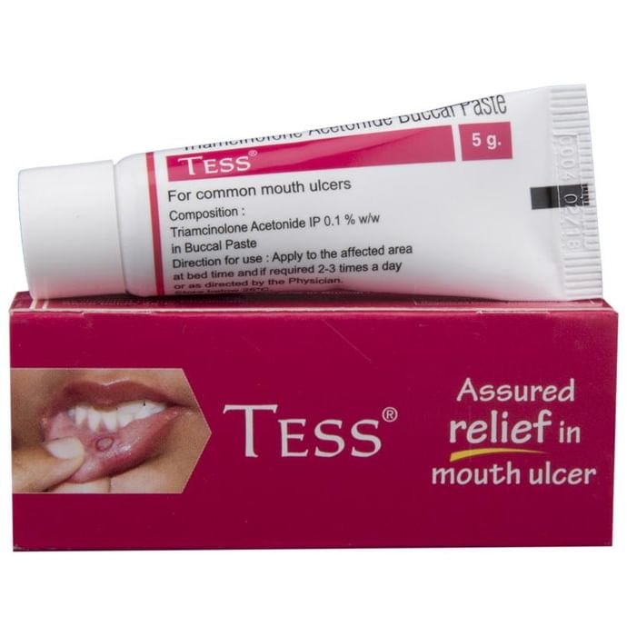 Tess Oral Paste    Triamcinolone 0.1% w/w